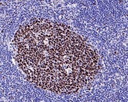 Invitrogen MSH6 Recombinant Rabbit Monoclonal Antibody (PD00-26) 100 &mu;L;