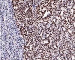 Invitrogen MSH6 Recombinant Rabbit Monoclonal Antibody (PD00-26) 100 &mu;L;