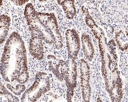 Invitrogen MSH6 Recombinant Rabbit Monoclonal Antibody (PD00-26) 100 &mu;L;