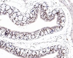 Invitrogen MSH6 Recombinant Rabbit Monoclonal Antibody (PD00-26) 100 &mu;L;