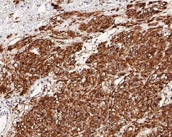 Invitrogen DOG-1 Recombinant Rabbit Monoclonal Antibody (PO00-27) 100 &mu;L;