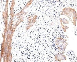 Invitrogen DOG-1 Recombinant Rabbit Monoclonal Antibody (PO00-27) 100 &mu;L;