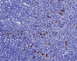 Invitrogen Mesothelin Recombinant Rabbit Monoclonal Antibody (PD00-68)
