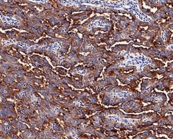 Invitrogen Mesothelin Recombinant Rabbit Monoclonal Antibody (PD00-68)