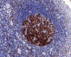 Invitrogen Stathmin 1 Recombinant Rabbit Monoclonal Antibody (PD00-54)