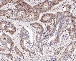 Invitrogen c-Myc Recombinant Rabbit Monoclonal Antibody (PS00-11) 100 &mu;L;