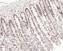Invitrogen c-Myc Recombinant Rabbit Monoclonal Antibody (PS00-11) 100 &mu;L;