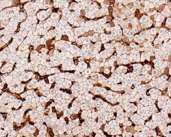 Invitrogen Hemoglobin alpha Recombinant Rabbit Monoclonal Antibody (PD00-16)