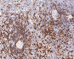 Invitrogen Hemoglobin alpha Recombinant Rabbit Monoclonal Antibody (PD00-16)