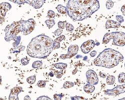 Invitrogen Hemoglobin alpha Recombinant Rabbit Monoclonal Antibody (PD00-16)