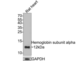 Invitrogen Hemoglobin alpha Recombinant Rabbit Monoclonal Antibody (PD00-16)