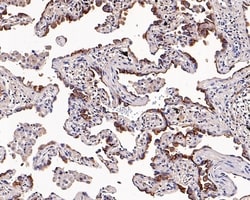 Invitrogen SLC34A2 Recombinant Rabbit Monoclonal Antibody (PD00-69) 100