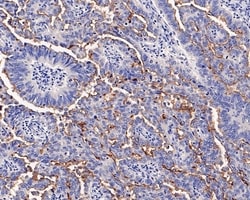 Invitrogen SLC34A2 Recombinant Rabbit Monoclonal Antibody (PD00-69) 100