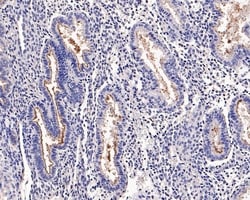 Invitrogen SLC34A2 Recombinant Rabbit Monoclonal Antibody (PD00-69) 100