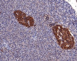 Invitrogen ENT1 Recombinant Rabbit Monoclonal Antibody (PD00-77) 100 &mu;L;