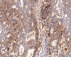 Invitrogen ENT1 Recombinant Rabbit Monoclonal Antibody (PD00-77) 100 &mu;L;