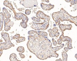 Invitrogen ENT1 Recombinant Rabbit Monoclonal Antibody (PD00-77) 100 &mu;L;