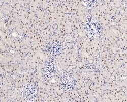 Invitrogen NPM1 Recombinant Rabbit Monoclonal Antibody (PD00-91) 100 &mu;L;