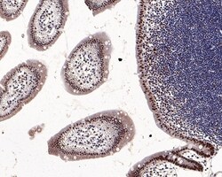 Invitrogen NPM1 Recombinant Rabbit Monoclonal Antibody (PD00-91) 100 &mu;L;