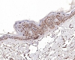 Invitrogen NPM1 Recombinant Rabbit Monoclonal Antibody (PD00-91) 100 &mu;L;