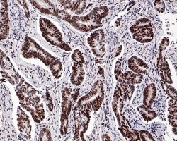Invitrogen NPM1 Recombinant Rabbit Monoclonal Antibody (PD00-91) 100 &mu;L;