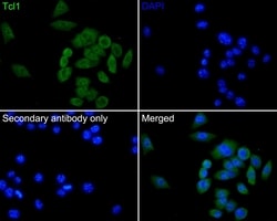 Invitrogen TCL1A Recombinant Rabbit Monoclonal Antibody (PD00-94) 100 &mu;L;