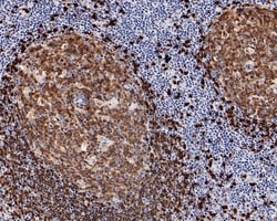 Invitrogen TCL1A Recombinant Rabbit Monoclonal Antibody (PD00-94) 100 &mu;L;