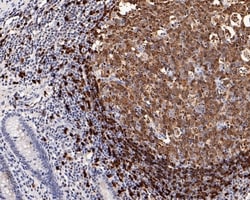 Invitrogen TCL1A Recombinant Rabbit Monoclonal Antibody (PD00-94) 100 &mu;L;