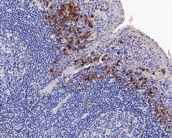 Invitrogen VIPR1 Recombinant Rabbit Monoclonal Antibody (PD00-96) 100 &mu;L;