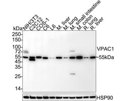Invitrogen VIPR1 Recombinant Rabbit Monoclonal Antibody (PD00-96) 100 &mu;L;