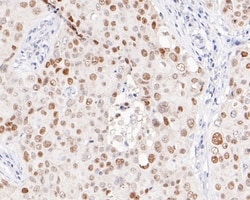 Invitrogen p53 Recombinant Rabbit Monoclonal Antibody (PD01-32) 100 &mu;L;
