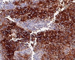 Invitrogen NAPSA Recombinant Rabbit Monoclonal Antibody (PD01-30) 100 &mu;L;