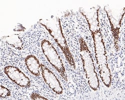 Invitrogen SATB2 Recombinant Rabbit Monoclonal Antibody (PD01-42) 100 &mu;L;