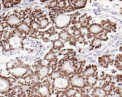 Invitrogen SATB2 Recombinant Rabbit Monoclonal Antibody (PD01-42) 100 &mu;L;