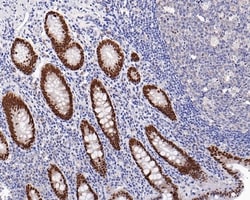 Invitrogen SATB2 Recombinant Rabbit Monoclonal Antibody (PD01-42) 100 &mu;L;