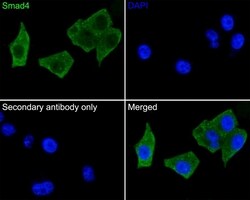 Invitrogen SMAD4 Recombinant Rabbit Monoclonal Antibody (PD01-37) 100 &mu;L;
