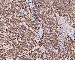 Invitrogen Bcl-2 Recombinant Rabbit Monoclonal Antibody (PD01-41) 100 &mu;L;