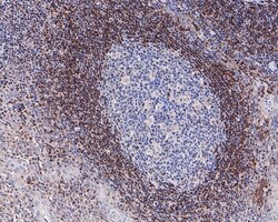 Invitrogen Bcl-2 Recombinant Rabbit Monoclonal Antibody (PD01-41) 100 &mu;L;