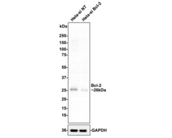 Invitrogen Bcl-2 Recombinant Rabbit Monoclonal Antibody (PD01-41) 100 &mu;L;