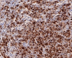 Invitrogen AFP Recombinant Rabbit Monoclonal Antibody (PD00-71) 100 &mu;L;