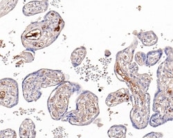 Invitrogen AFP Recombinant Rabbit Monoclonal Antibody (PD00-71) 100 &mu;L;