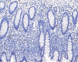 Invitrogen SOX10 Recombinant Rabbit Monoclonal Antibody (PDH0-05) 100 &mu;L;