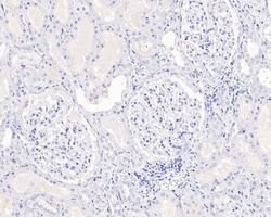 Invitrogen SOX10 Recombinant Rabbit Monoclonal Antibody (PDH0-05) 100 &mu;L;