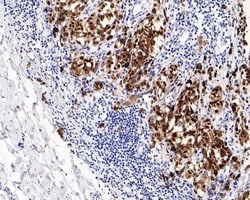 Invitrogen SOX10 Recombinant Rabbit Monoclonal Antibody (PDH0-05) 100 &mu;L;