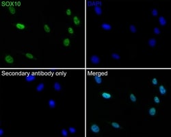 Invitrogen&trade;&nbsp;SOX10 Recombinant Rabbit Monoclonal Antibody (PDH0-04)