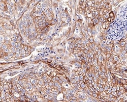 Invitrogen B7-H3 Recombinant Rabbit Monoclonal Antibody (PD00-36) 100 &mu;L;