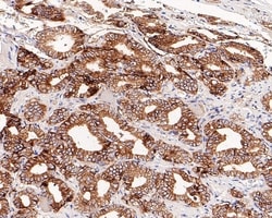 Invitrogen B7-H3 Recombinant Rabbit Monoclonal Antibody (PD00-36) 100 &mu;L;