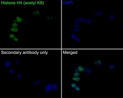 H4K8ac Recombinant Rabbit Monoclonal Antibody (PS01-25), Invitrogen 100