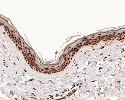 H4K8ac Recombinant Rabbit Monoclonal Antibody (PS01-25), Invitrogen 100