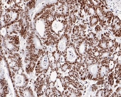 H4K8ac Recombinant Rabbit Monoclonal Antibody (PS01-25), Invitrogen 100